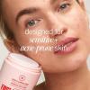 image:imageFirst Aid Beauty Acne Pads for Face  Maximum Strength Acne Treatment  2 Salicylic Acid Pads Treat Without Drying 60ct