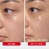 image:imageFirst Aid Beauty  Hydrating Eye Cream with Hyaluronic Acid Nourishing Eye Cream that Provides 24 hours of Hydration Helps Smooth Fine Lines Wrinkles amp Puffiness Safe for Sensitive Skin 05 oz